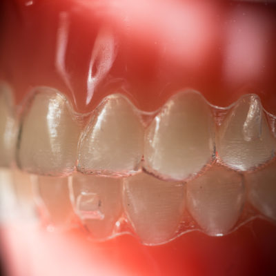 treatment-ortho-pictures-2966